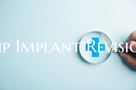 Hip Implant Revision