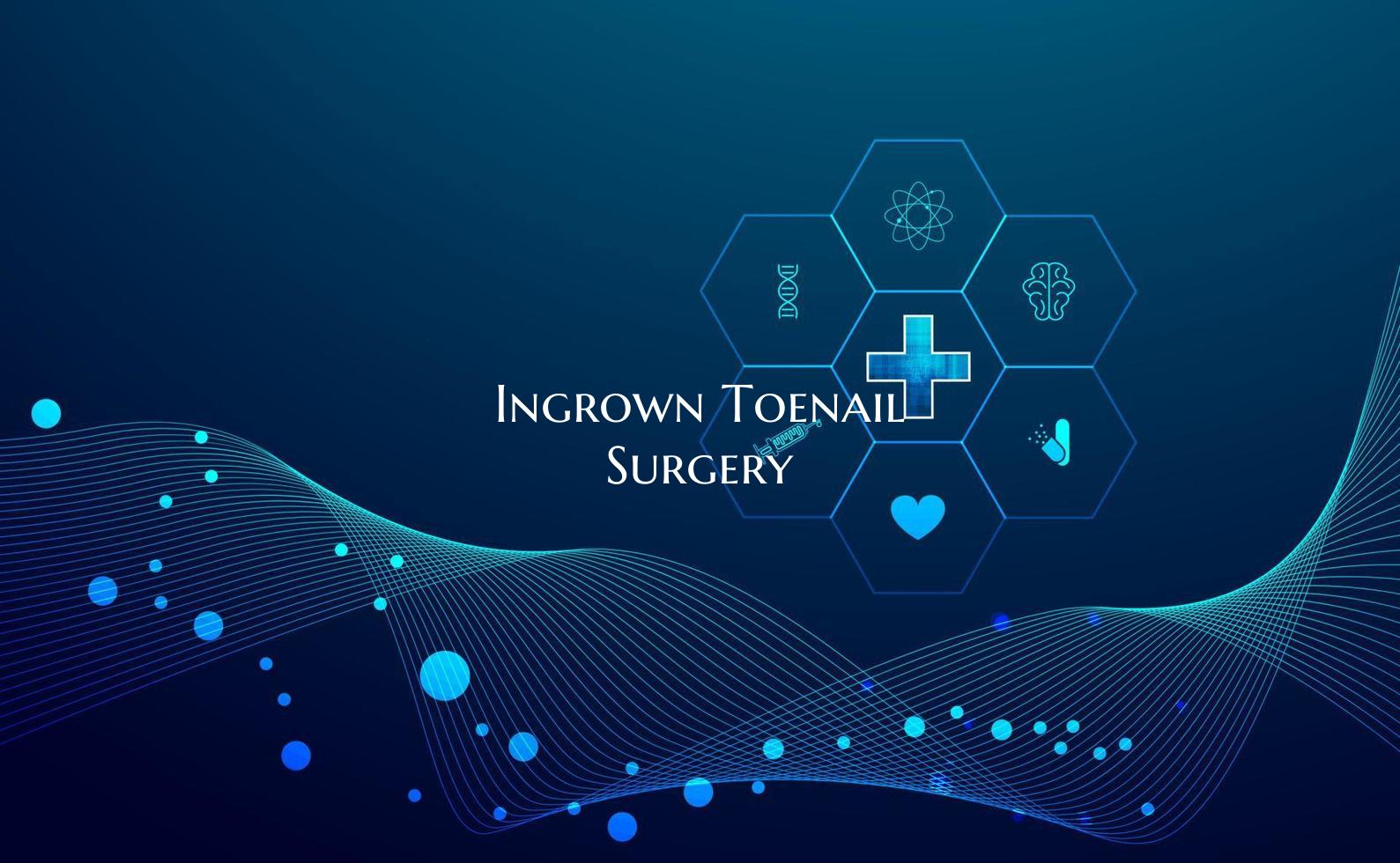 Ingrown Toenail Surgery
